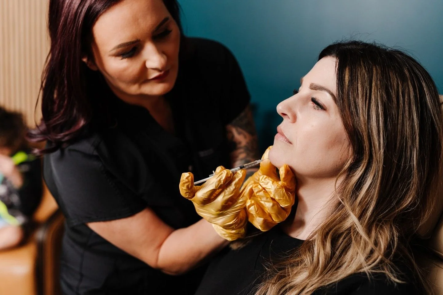She came in saying she just wanted "a little more definition." She left standing differently.

That's the thing about chin filler. It isn't about a dramatic change. It's the quiet shift that happens when your profile finally matches how you