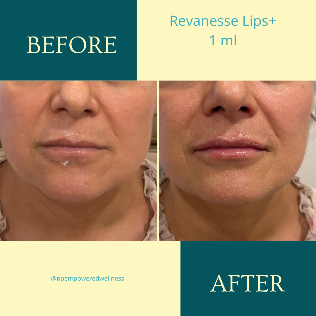 Copy of Copy of Instagram Before  (1).png