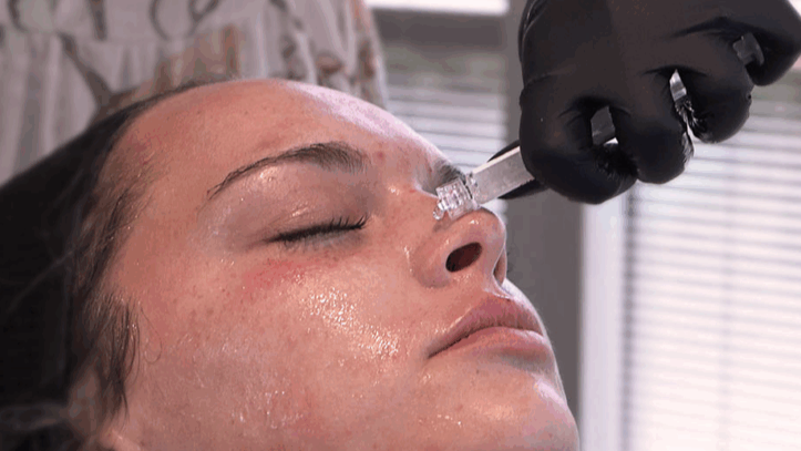 A woman receiving a facial treatment with a dropper applicator during a skincare procedure.