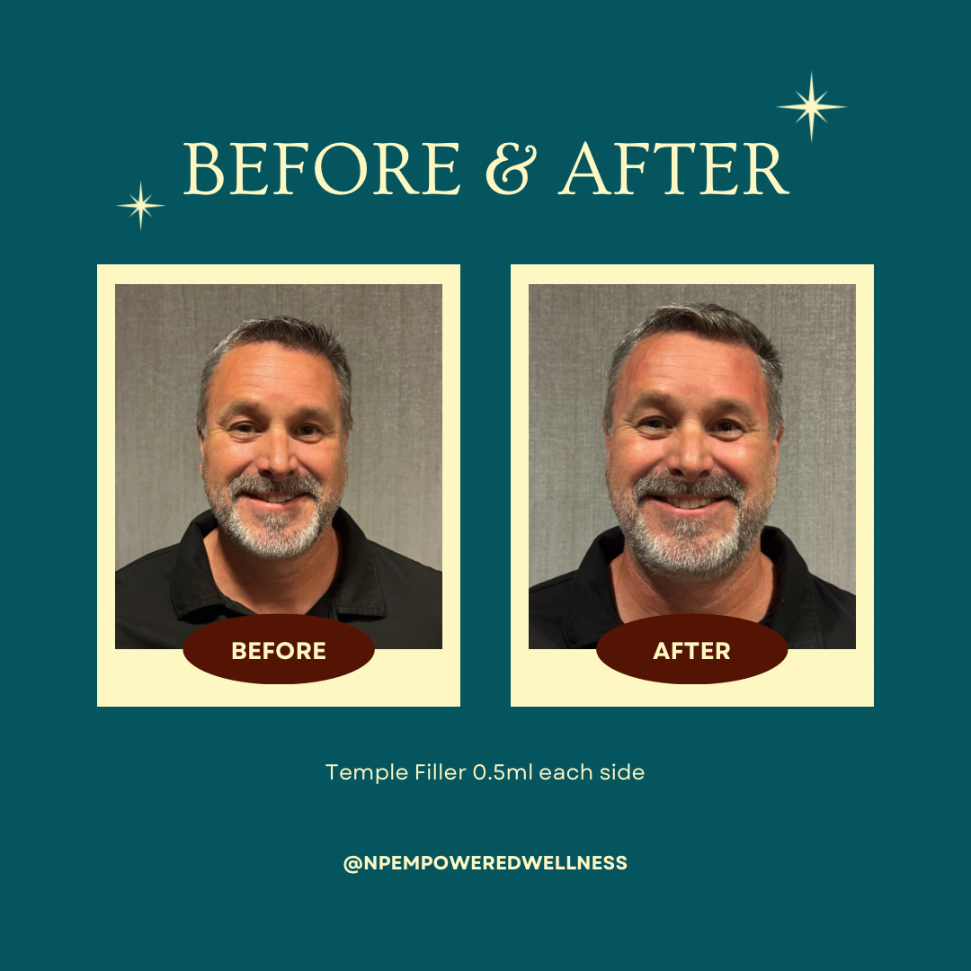 Copy of Copy of Instagram Before & After Template.PNG