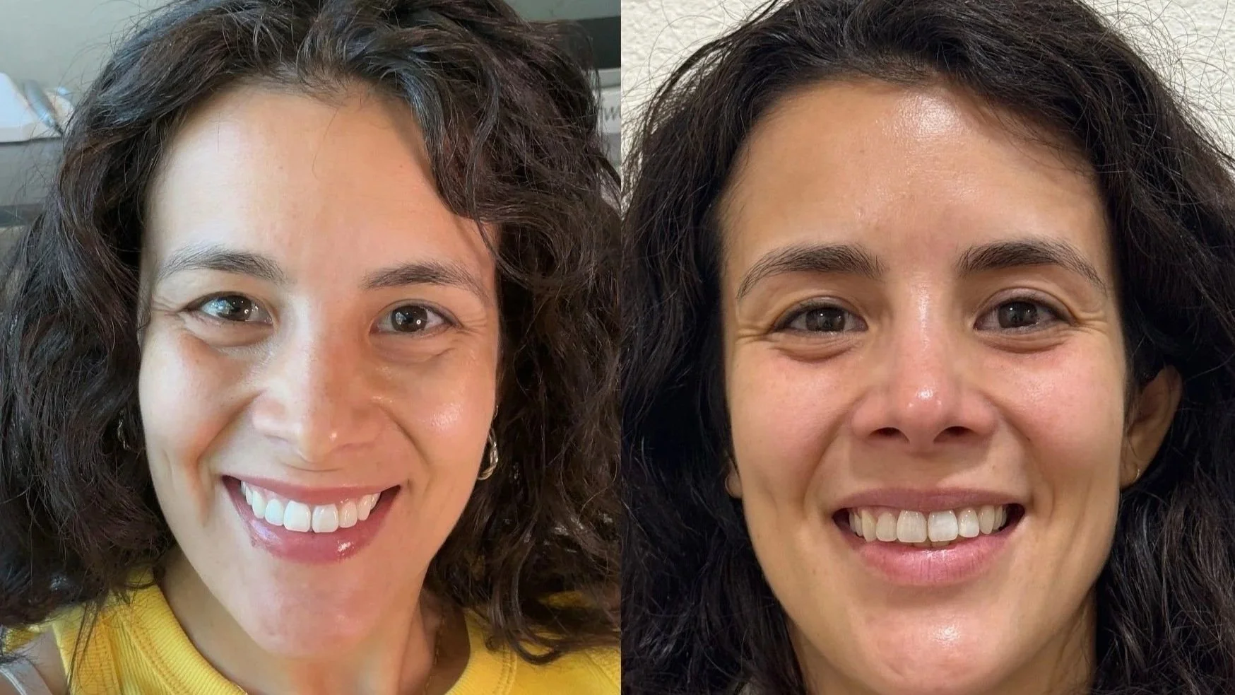 Side-by-side photos of two women smiling, showing their faces and hair.
