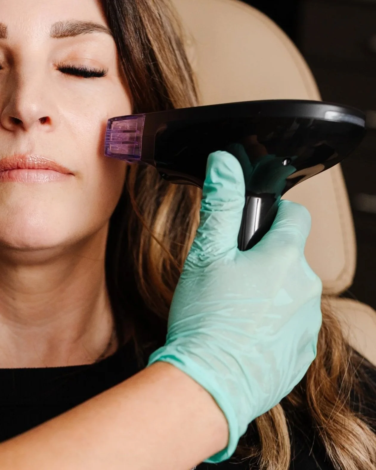 Close-up of a woman with closed eyes getting a facial treatment with a device held by a person wearing a light green glove.