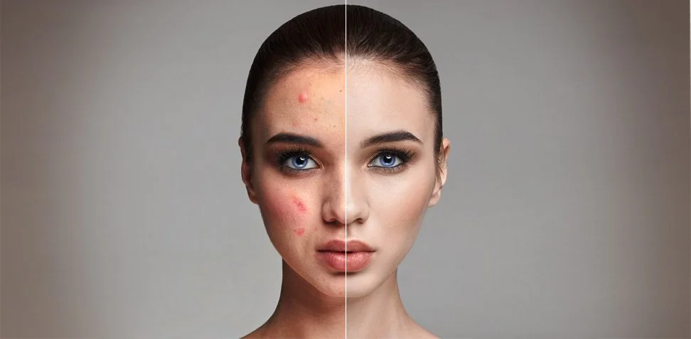 A young woman with her hair tied back, her face divided to show the before and after of the photo retouching process, highlighting the transformation with smooth skin and enhanced features