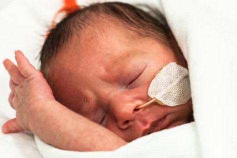 Newborn baby with oxygen tube in nose, sleeping with eyes closed, wrapped in a hospital blanket.