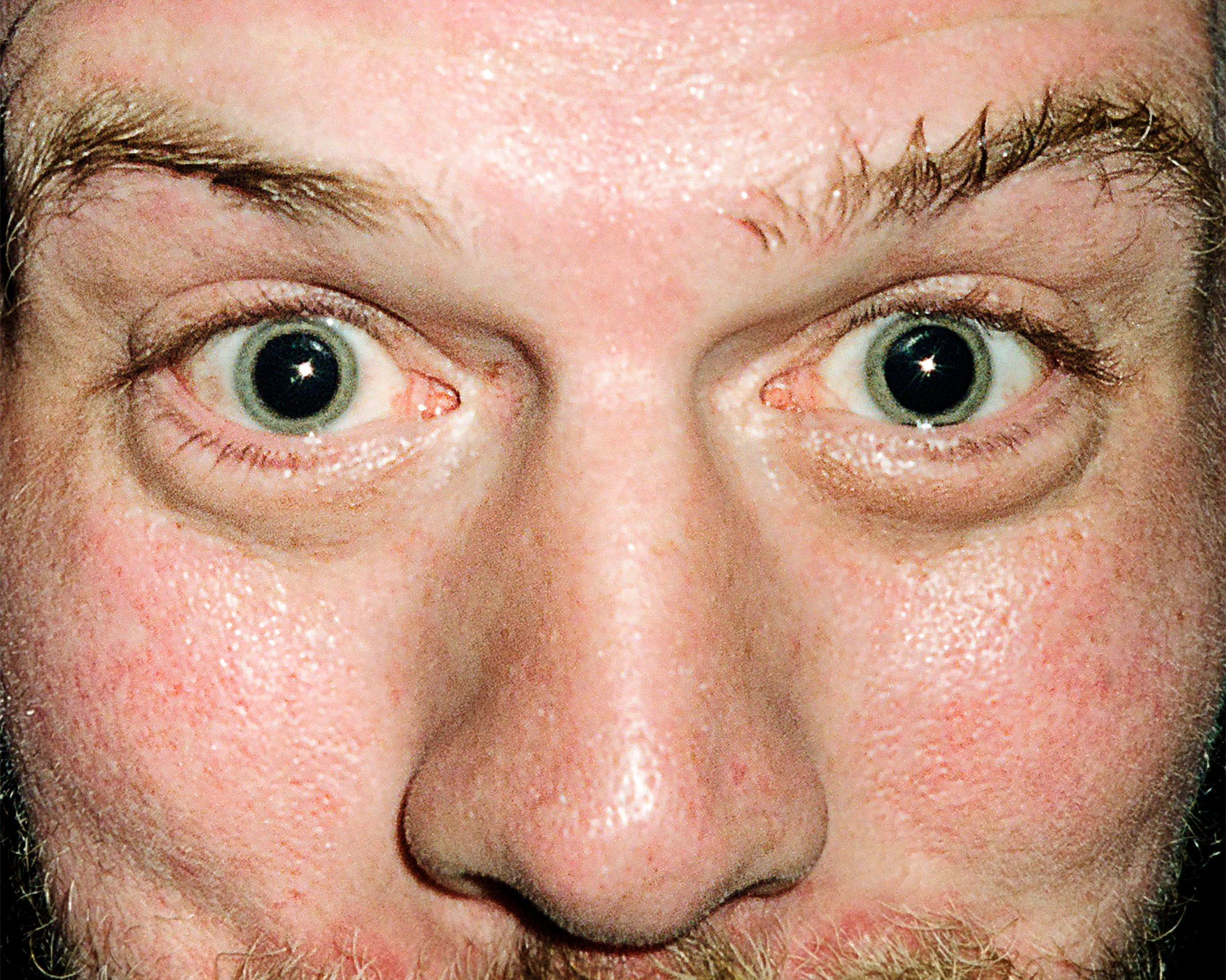 Close-up of a man's face with wide open eyes showing detailed irises and pupils, with visible eyelashes, eyebrows, and facial skin texture.
