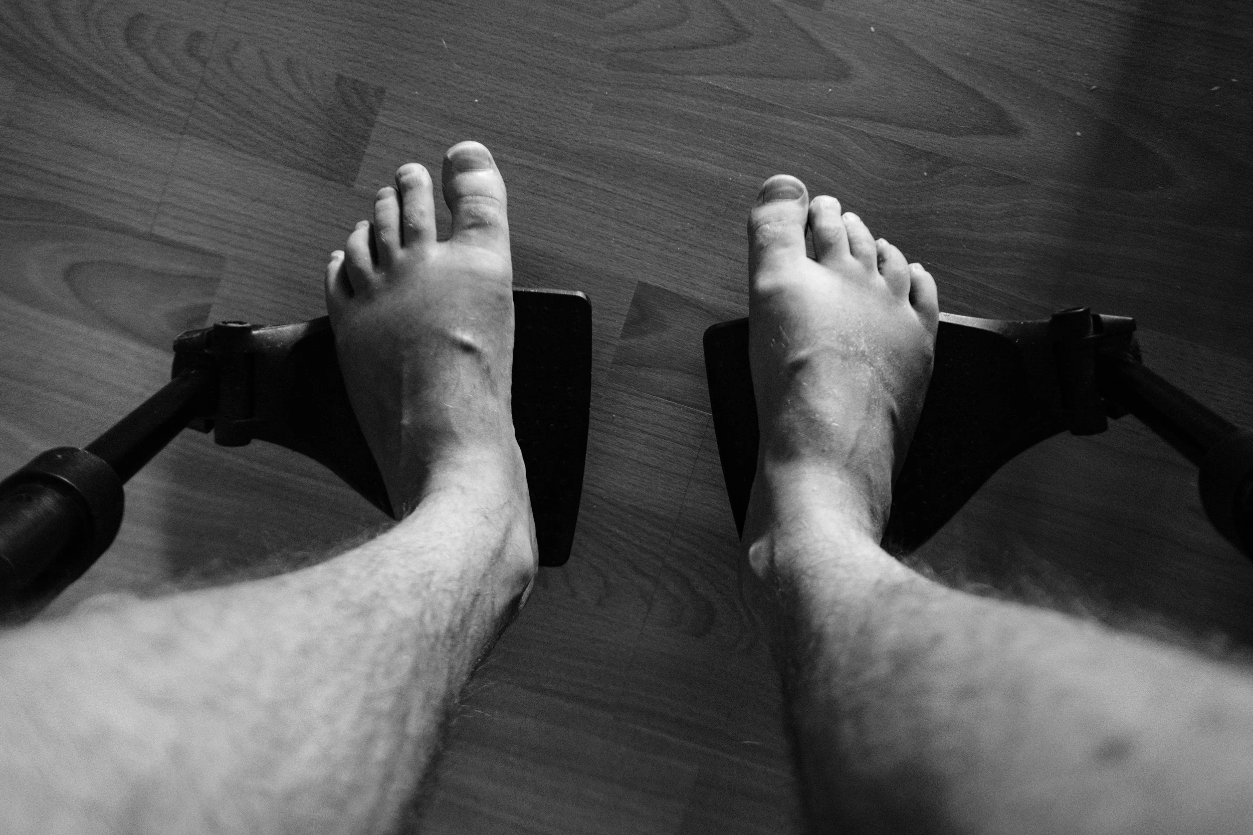 A black and white close-up shot of Niko’s feet resting on wheelchair footrests. The feet appear swollen, and the floor beneath them is made of laminate.