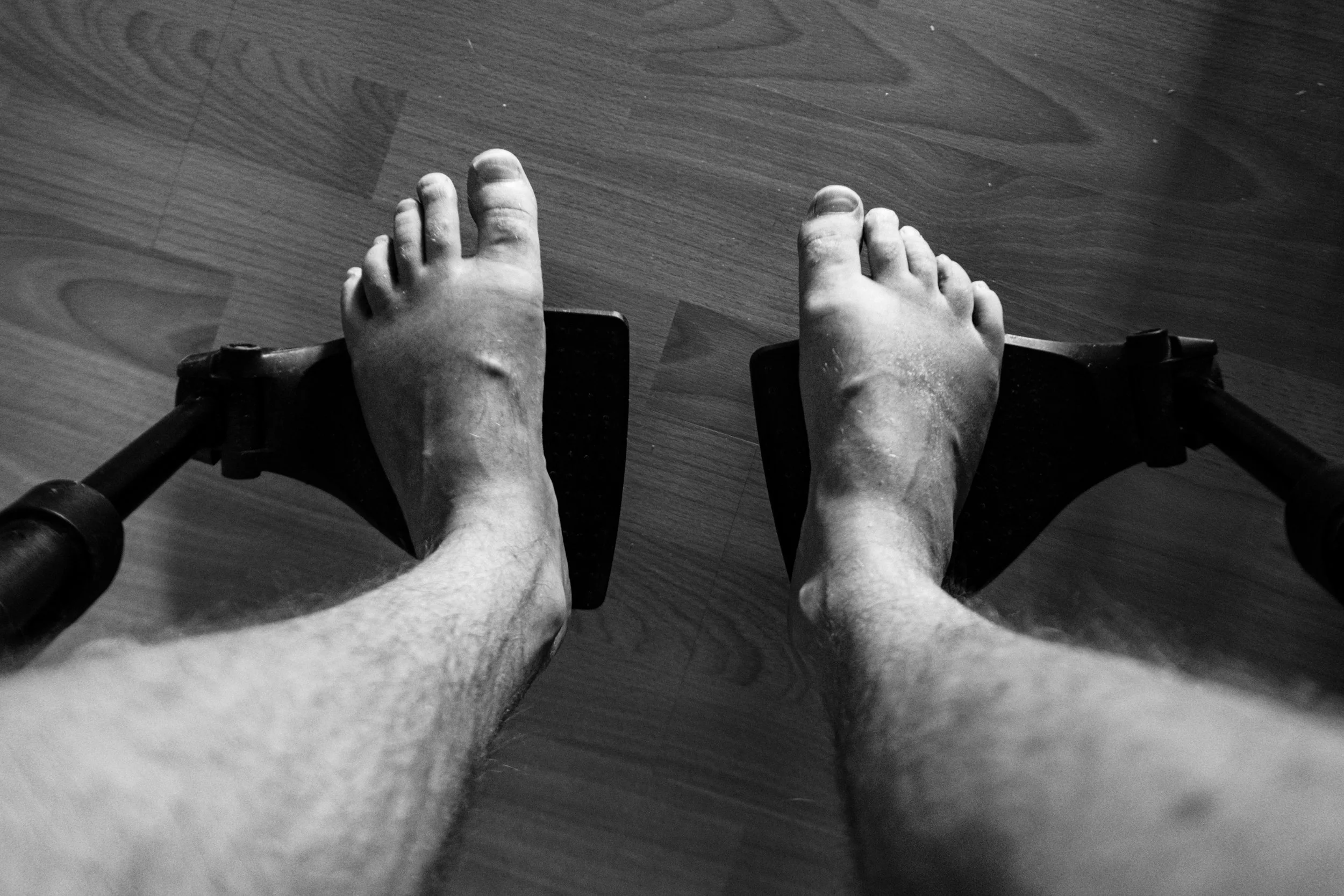 A black-and-white close-up shot of Niko’s feet resting on wheelchair footrests. The feet appear swollen, and the floor beneath them is made of laminate.