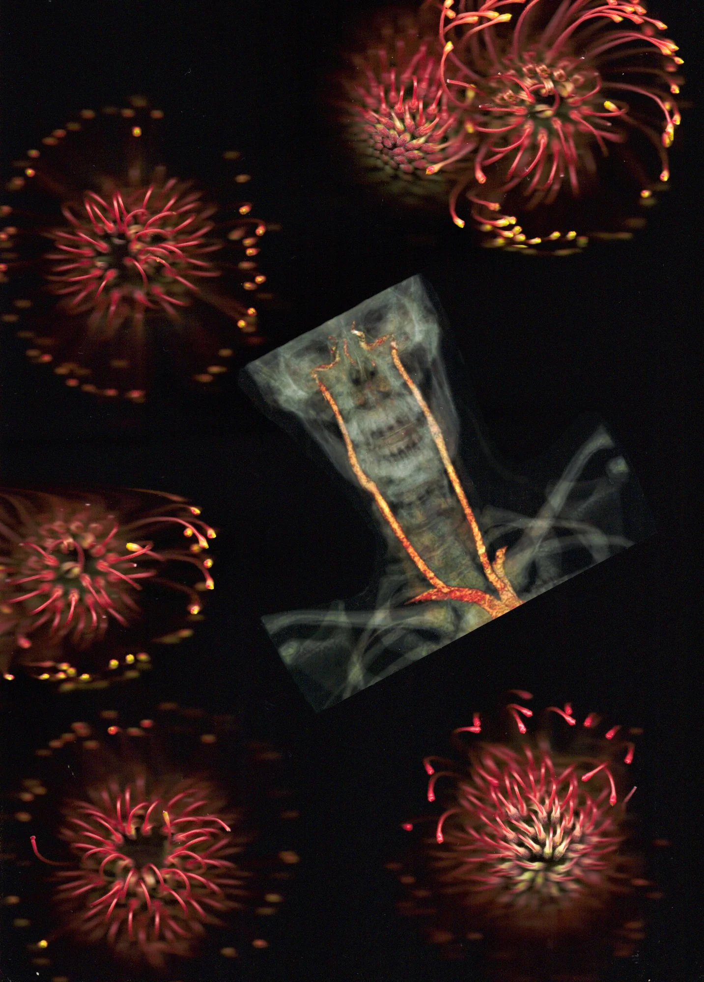 A scanography of various elements: red protea flowers and a CT venogram of a human skull that has yellow and red lines coming out of the eye sockets.