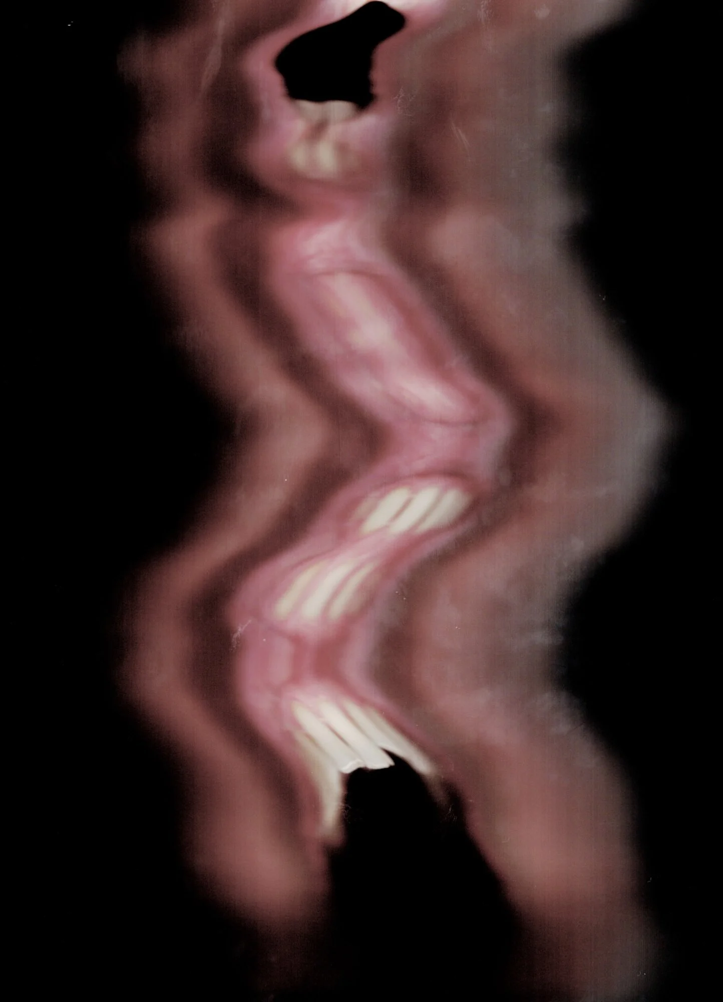 A distorted photograph of a mouth and teeth that appears to be multiplied against a black background.