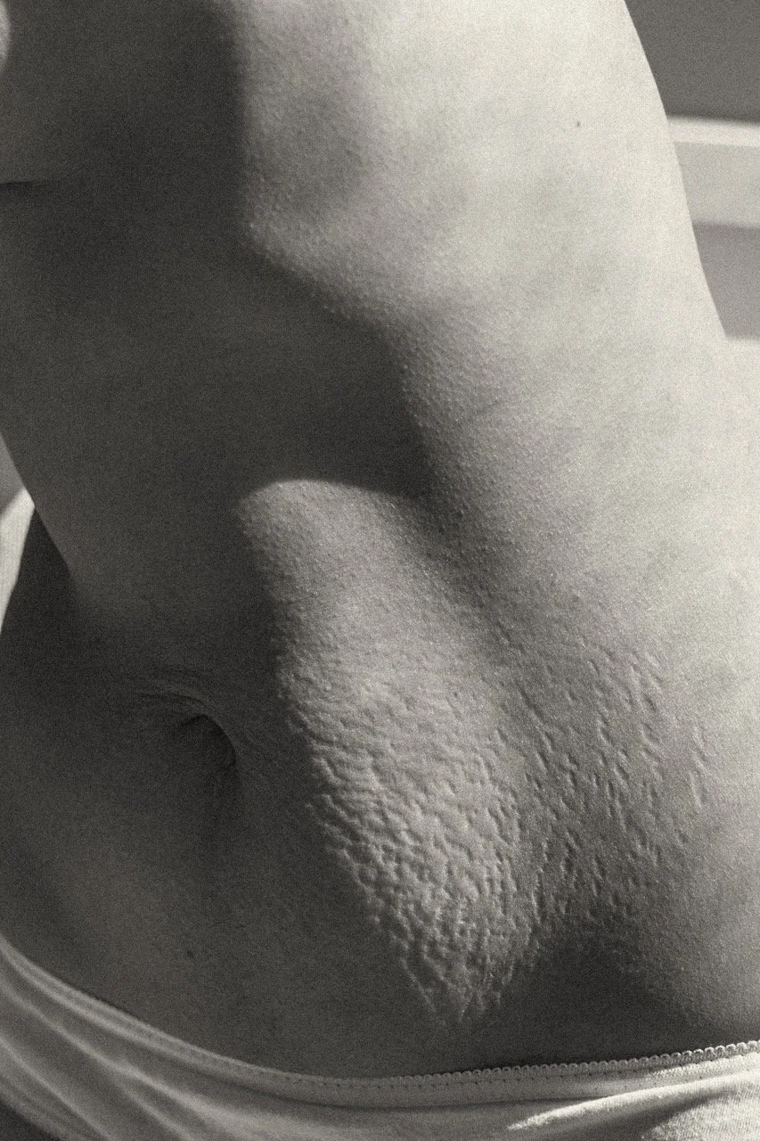 Close up of a postpartum belly covered in stretch marks — real, raw, and beautiful. mark of strength and sacrifice, documented with care. Documentary motherhood photography in Tokyo, Paris, Saigon.