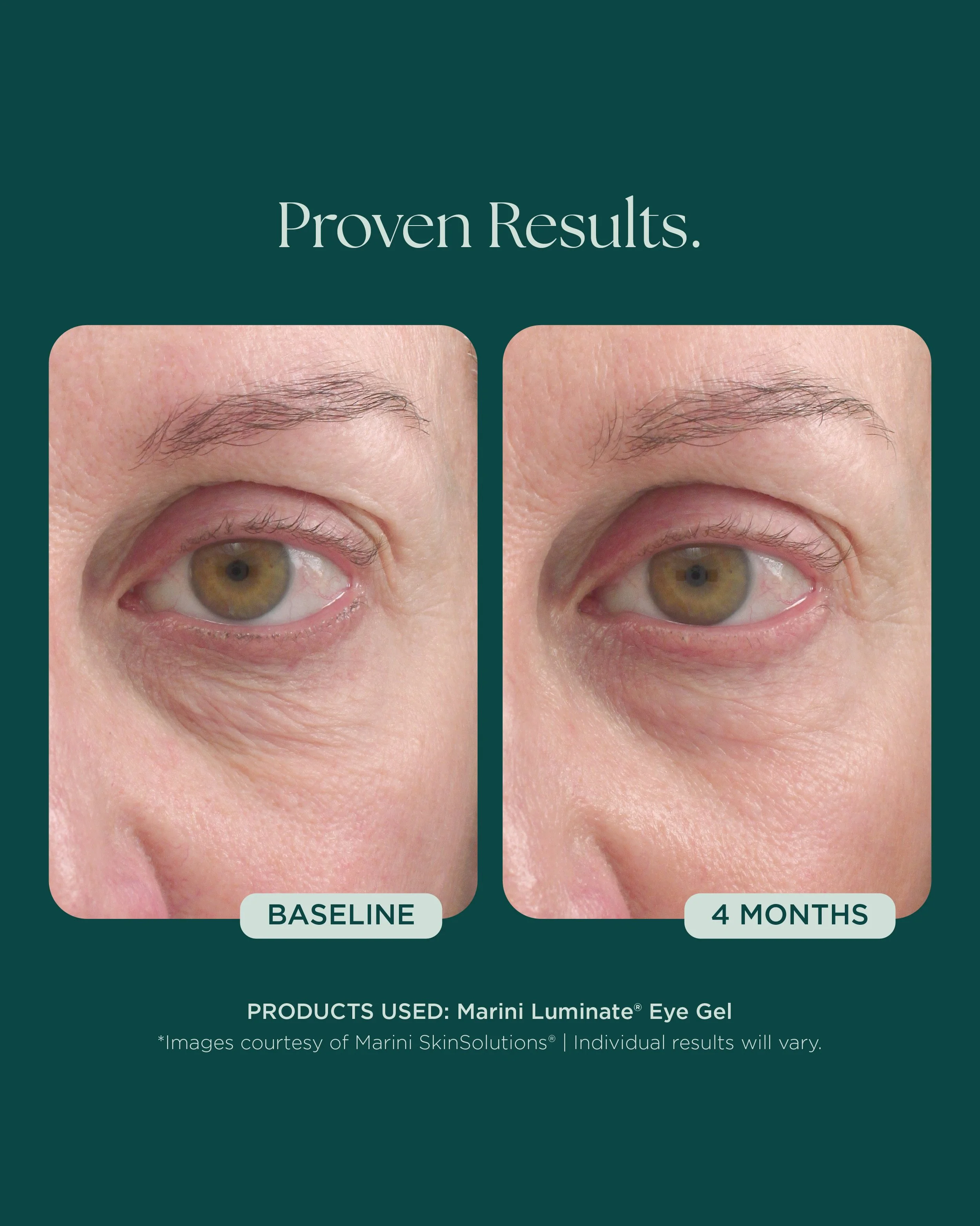 MSS26_Social_Before&Afters_BODY-NECK-EYES-HANDS_052826__EYES-01.jpg