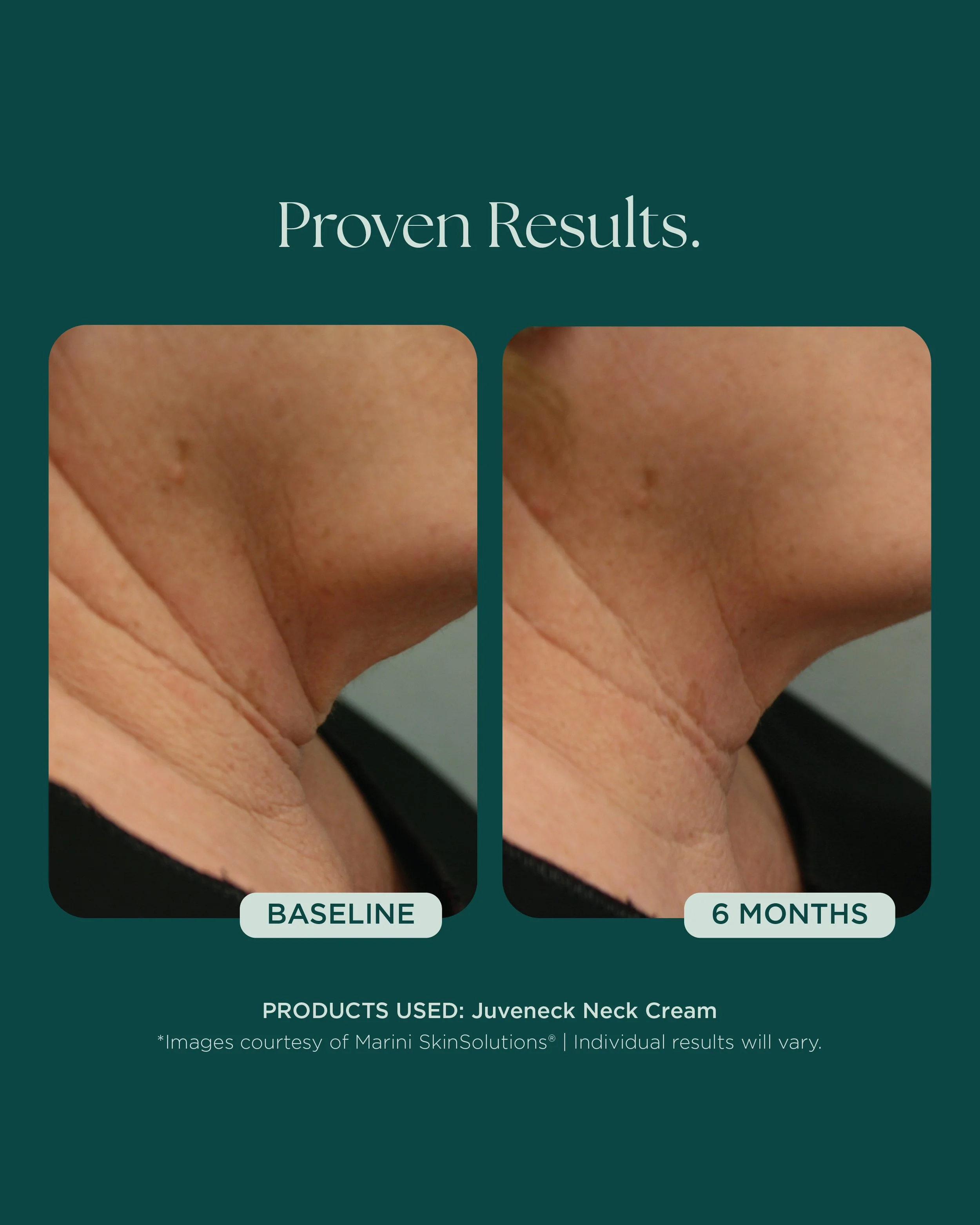 MSS26_Social_Before&Afters_BODY-NECK-EYES-HANDS_052826__NECK-8013.jpg