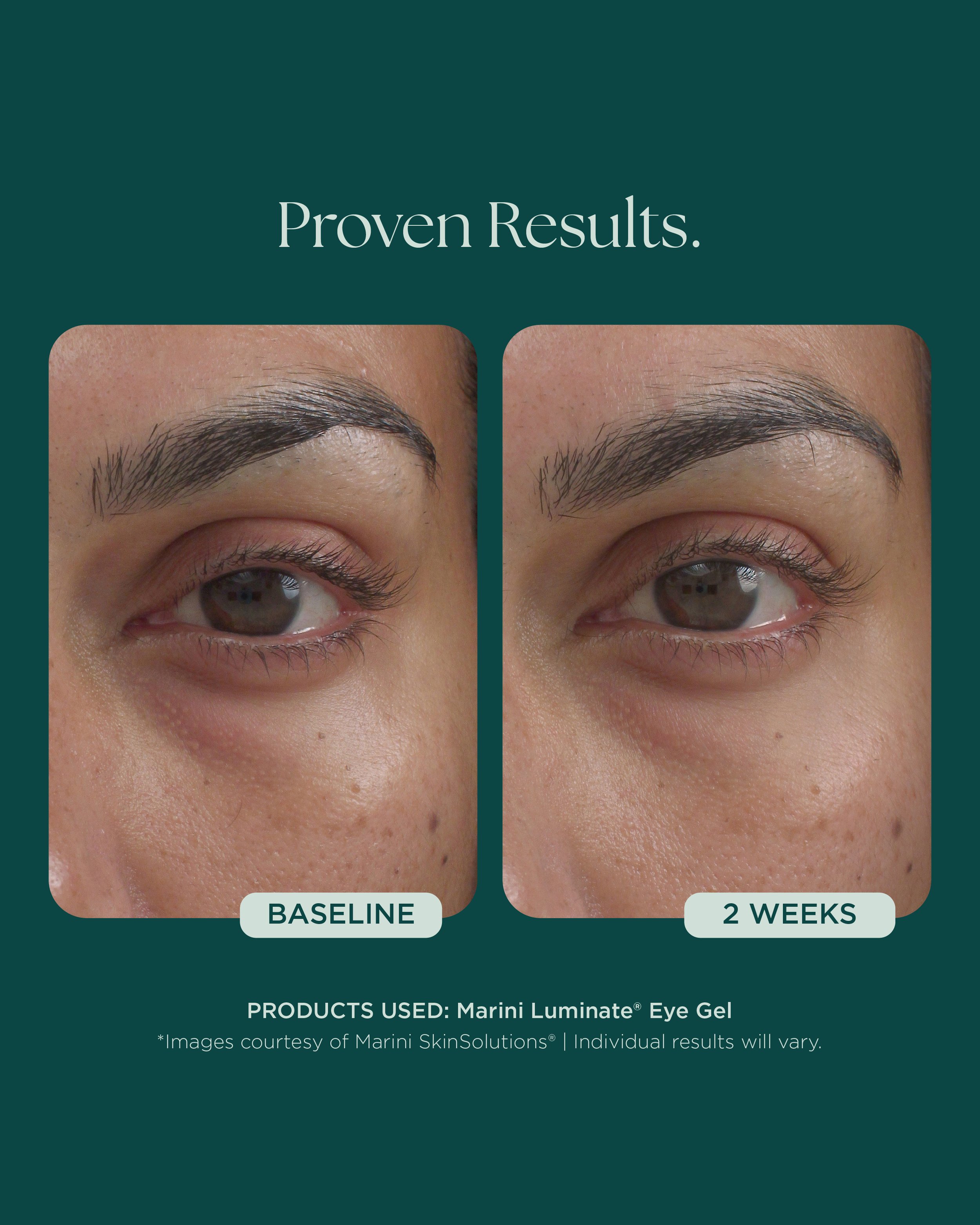 MSS26_Social_Before&Afters_BODY-NECK-EYES-HANDS_052826__EYES-03.jpg