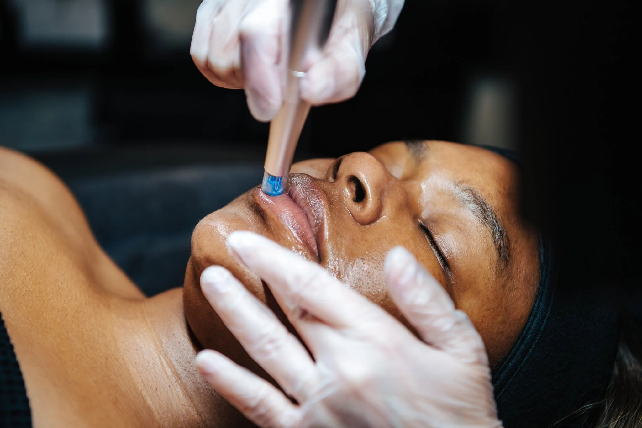 A woman receiving a cosmetic lip treatment with a pipette from a professional wearing gloves.