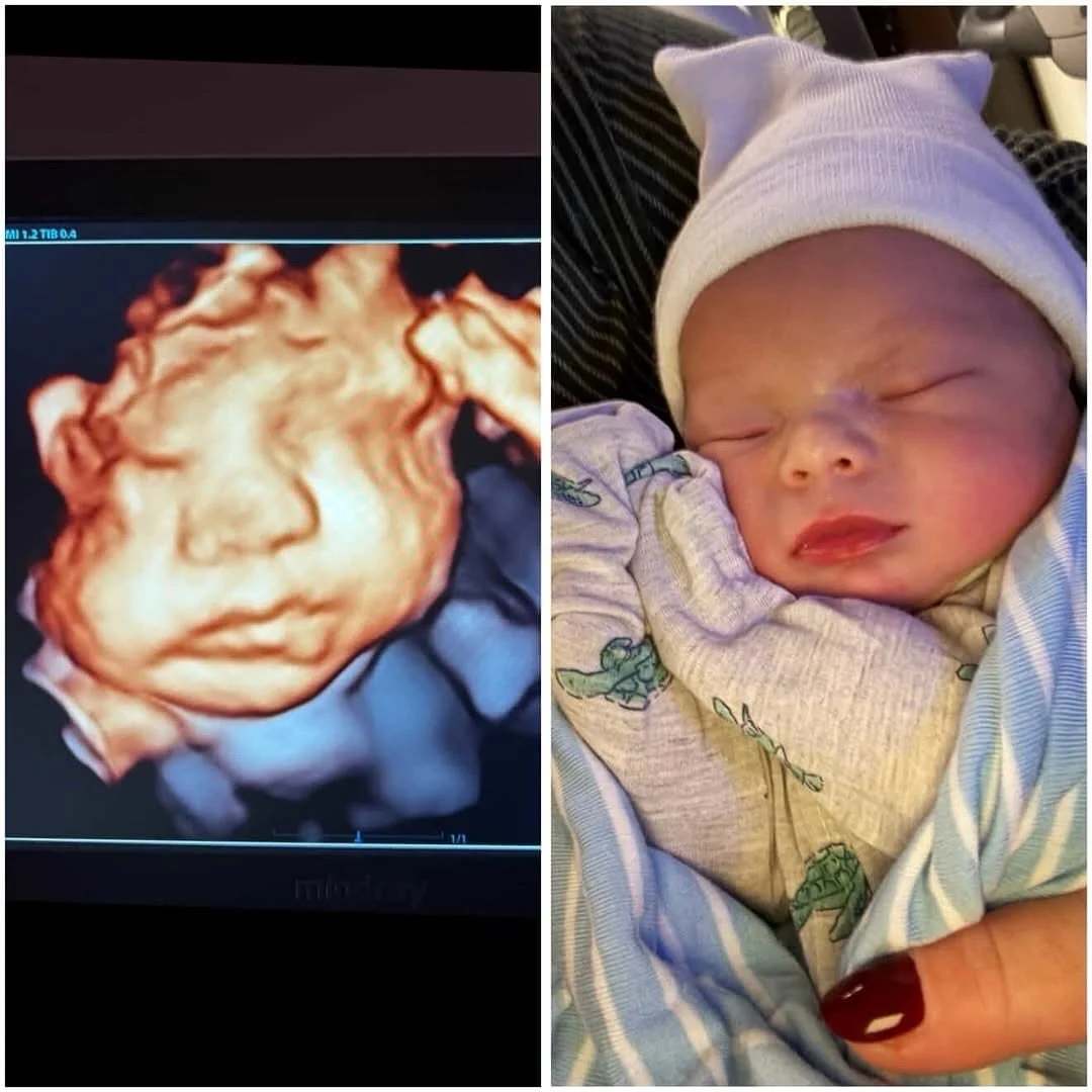 Look at this beautiful baby! He deserves a permanent spot on my timeline. I got to know his precious mama so well and we just had the best time watching her precious rainbow 🌈baby growing inside her. I am beyond thankful for his life and being a sma