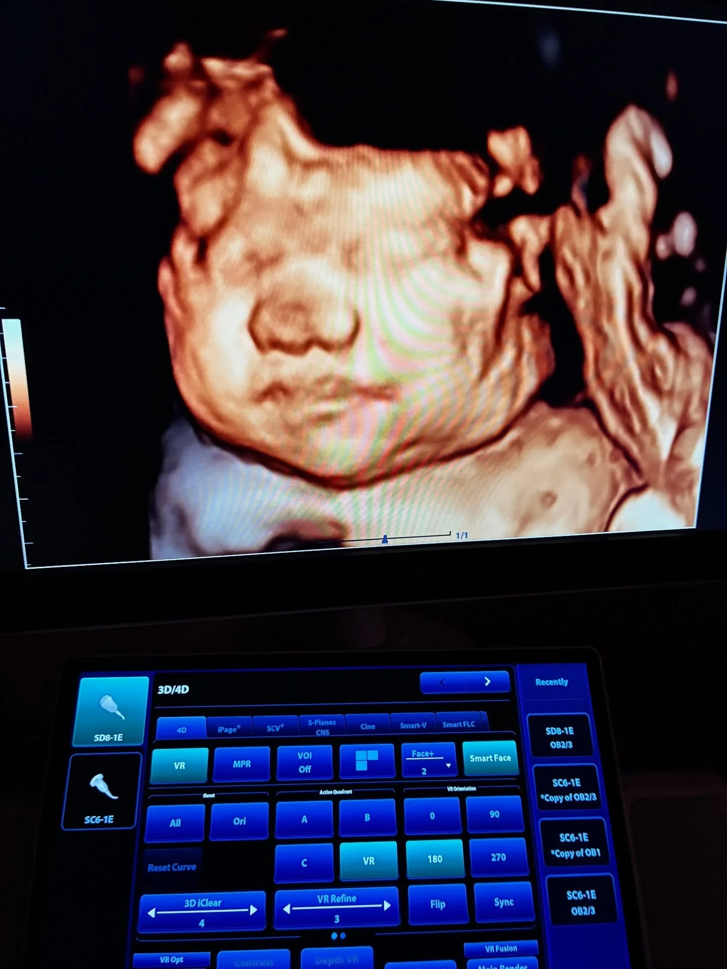 Look at this yummy chunky baby! 35 week rainbow baby and he was just so much fun to watch! I love this career 💕