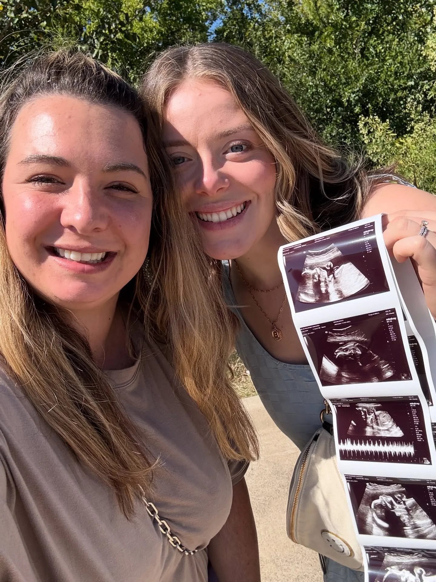 It&rsquo;s hard for me to wrap my brain around my wonderful friends wanting to drive 5+ hours for me to do their ultrasounds. It is truly one of the biggest honors of my life. They&rsquo;re trusting me with their babies. Wow. Thank you to my sweet fr