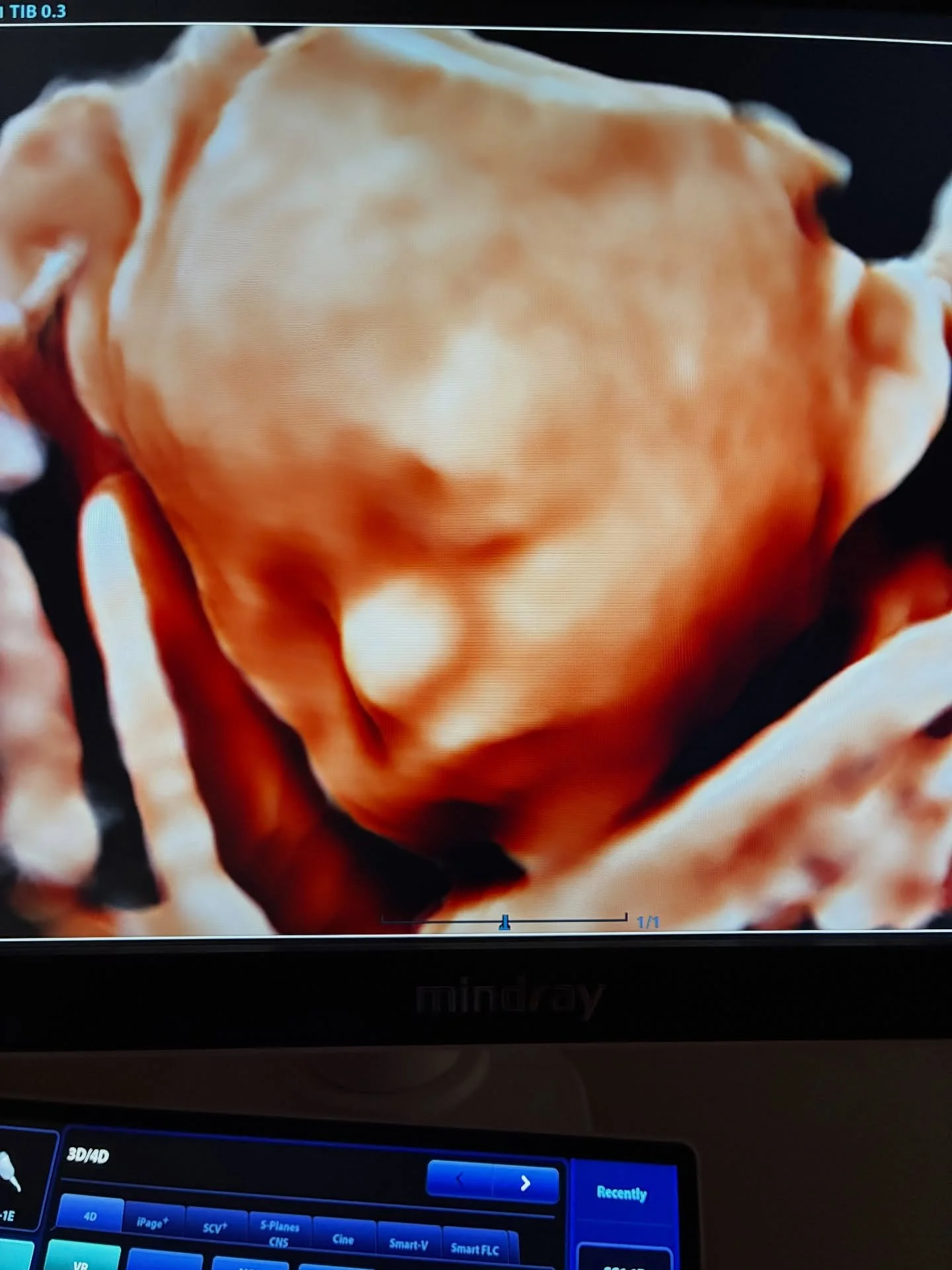 We are having evening appointments tonight! Come see us!