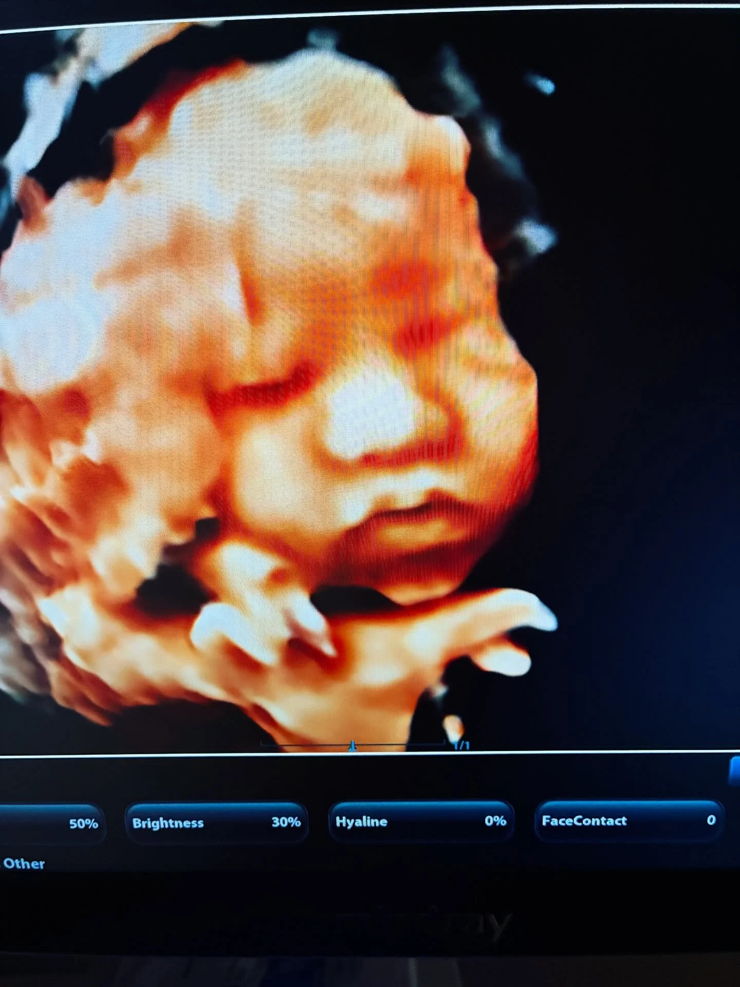 First born son did so good on his 3D session!