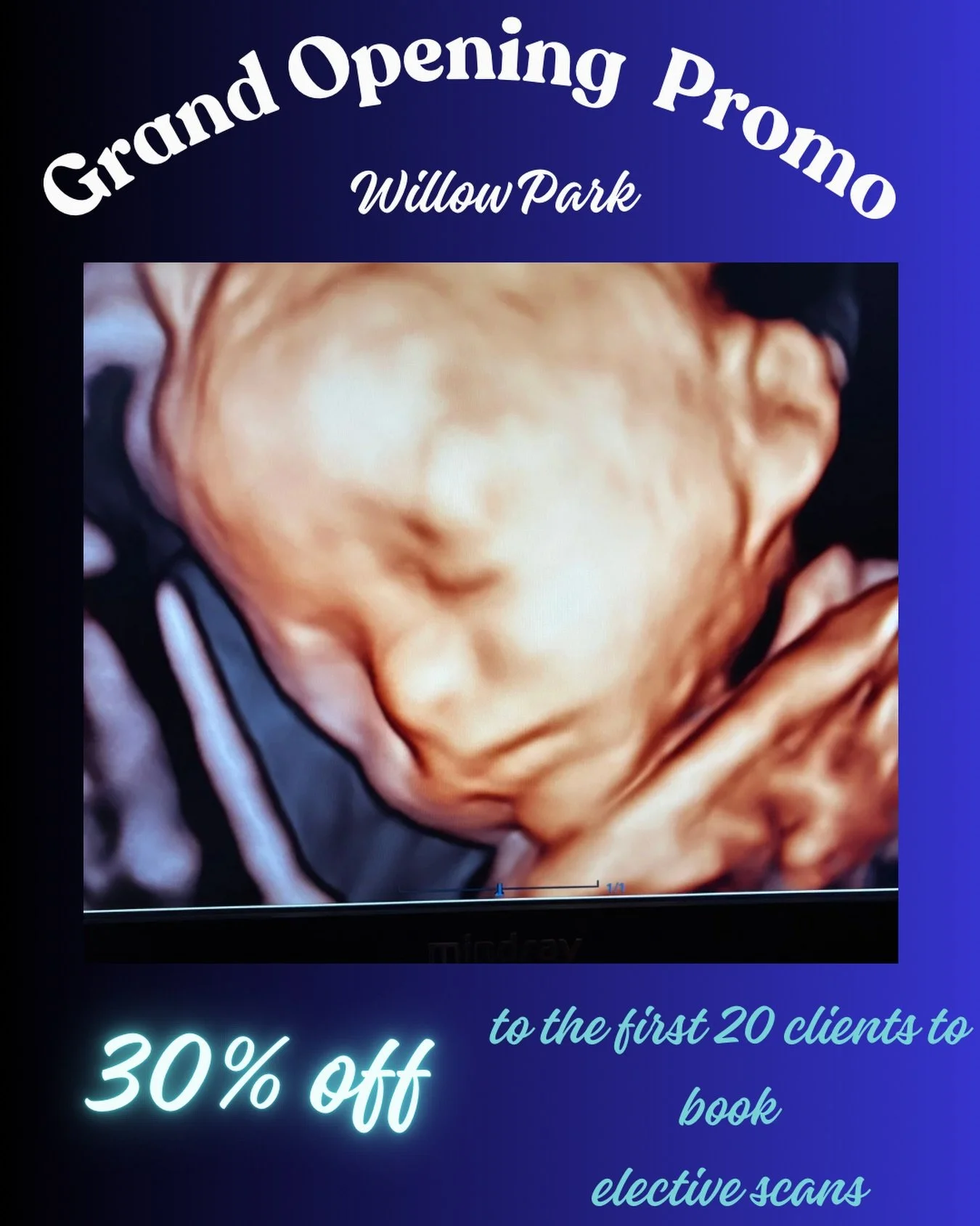 Opening January 5! The first 20 clients to book an elective scan will receive 30%off. It&rsquo;s our special way to meet our new community! These will go fast. #willowparktx #momsofaledo #3d4dultrasound #grandopeningweek #fortworthtx #pregnancy