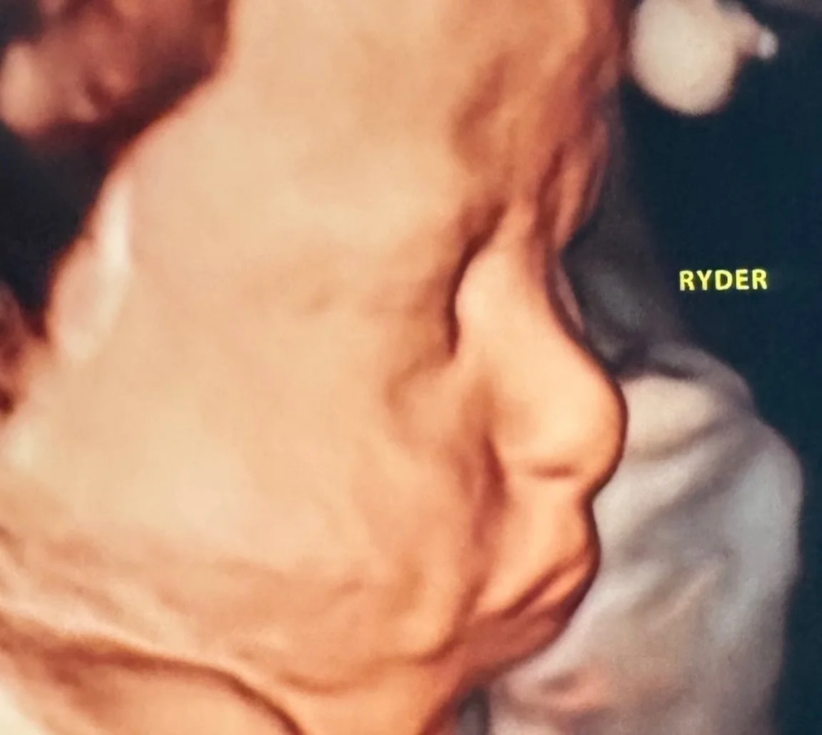 The same profile in and out! Thanks to this gorgeous mommy for sending us this one!!!