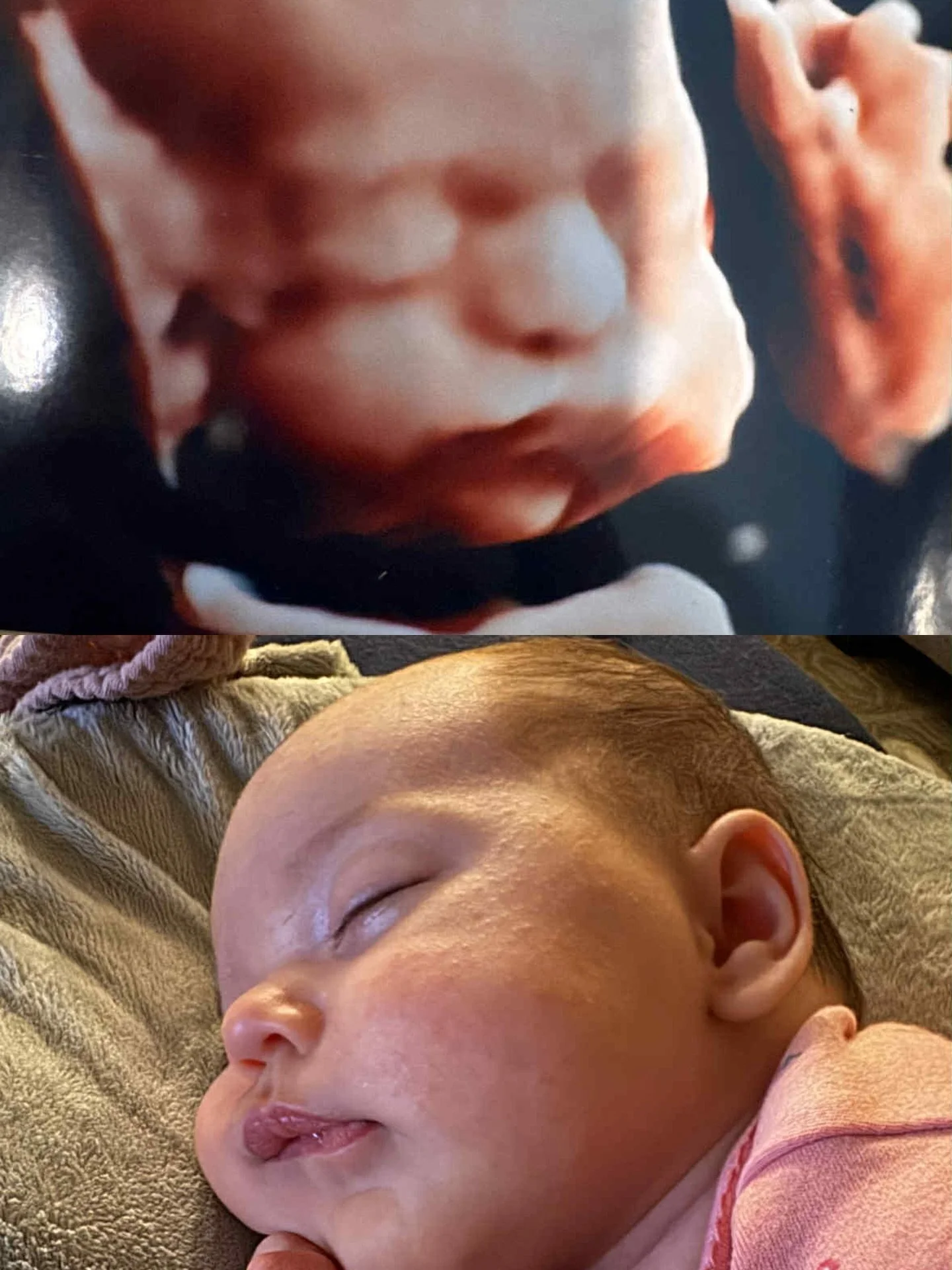 Please send us all the side by sides of your cute babies! This one is so precious and her 3D session was incredible. #3dultrasound #registeredsonographer #womanowned #fortworth #kellermoms