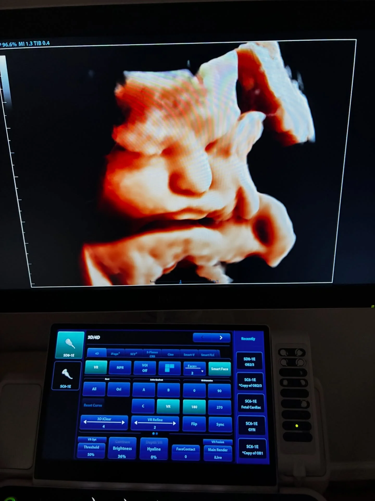 Almost 39 weeks! The ✨Last Look ✨Package gave us such a sweet baby face today! #babygirl  #3dultrasound #fortworthtx