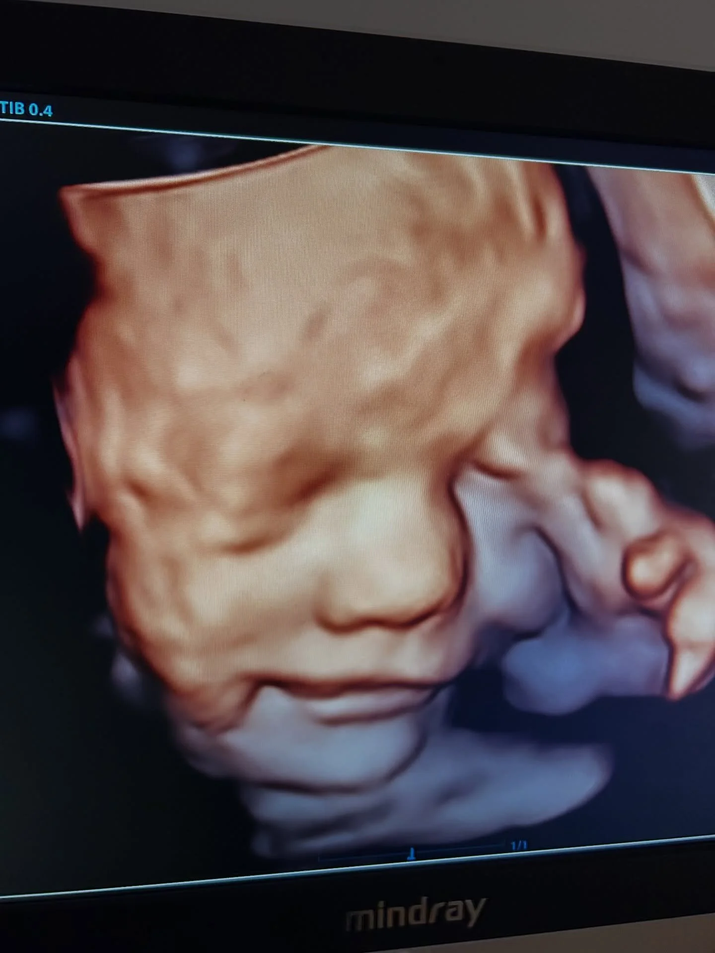 This baby is all smiles in Willow Park!😁😁 #ultrasoundstudio #willowparktx #momlife