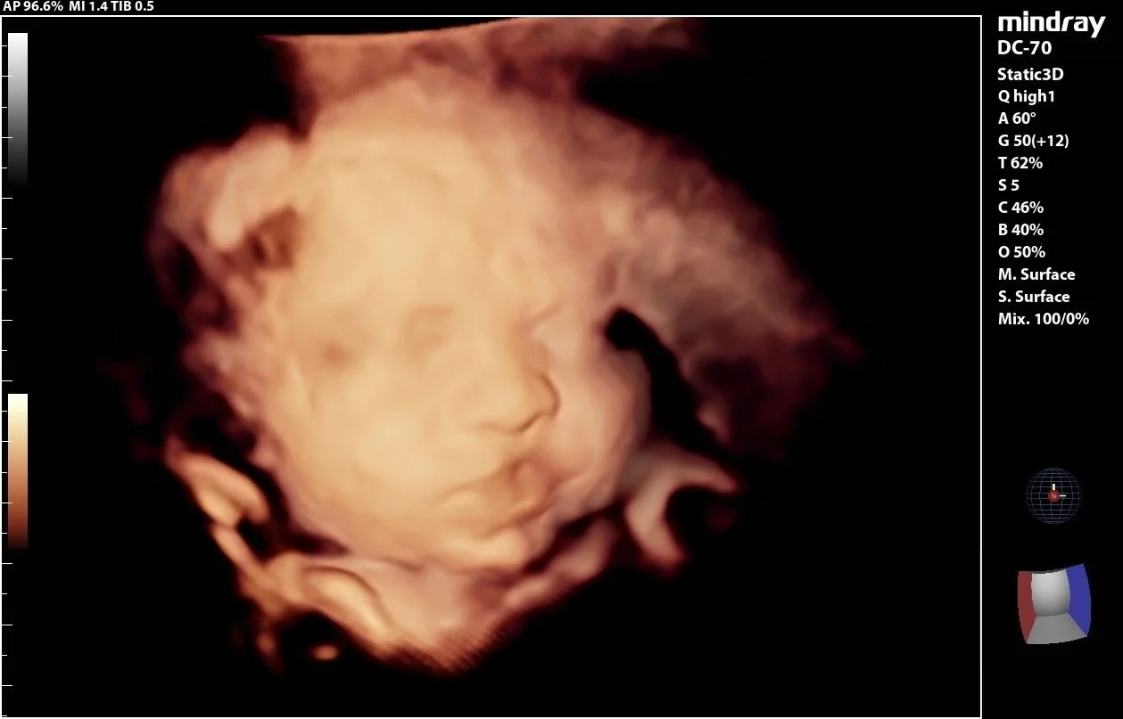 Kisses 😘for mama and daddy! Saturday scans are so sweet ✨