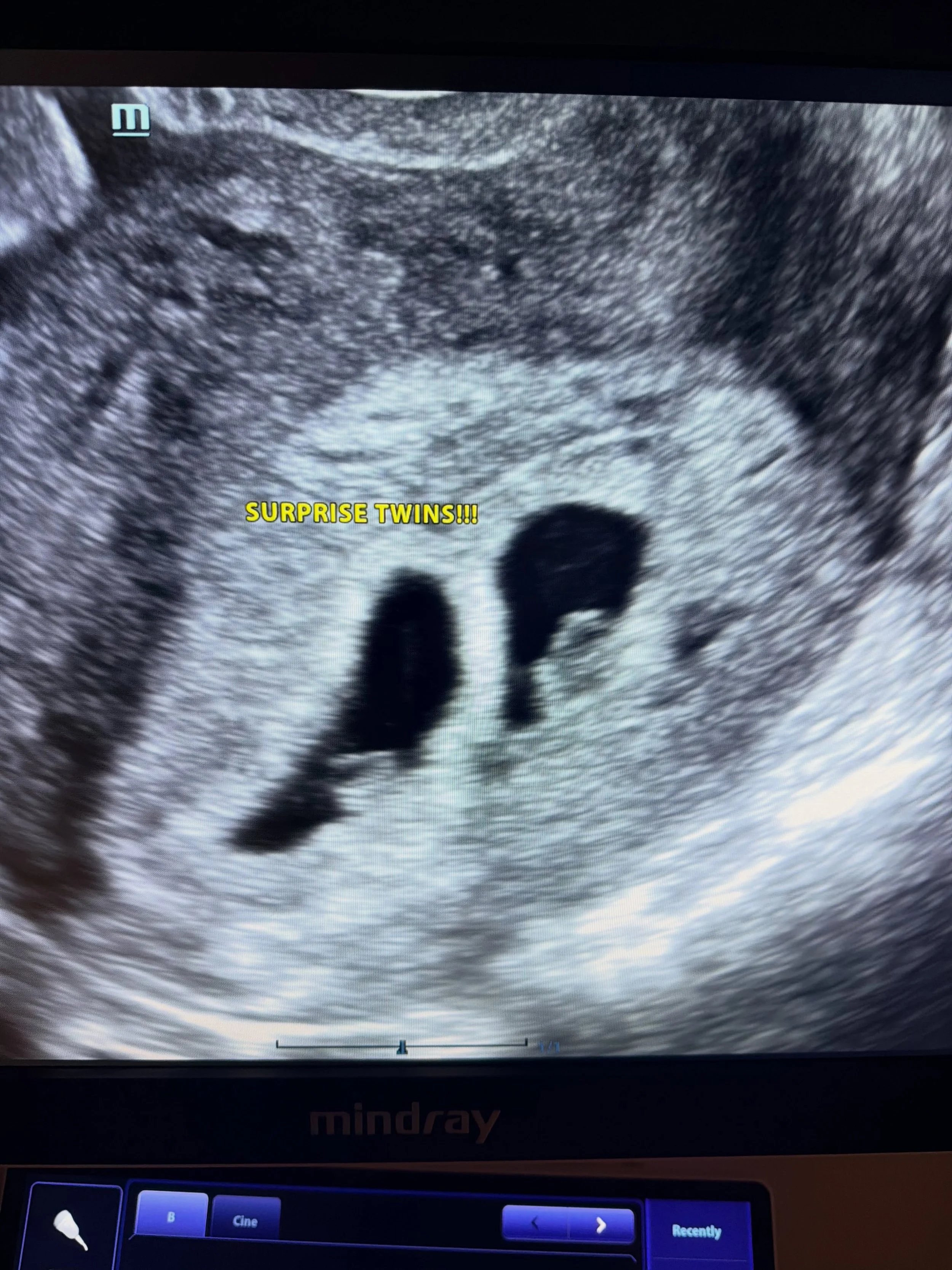 Exciting day! First set of twins for Willow Park! 👯