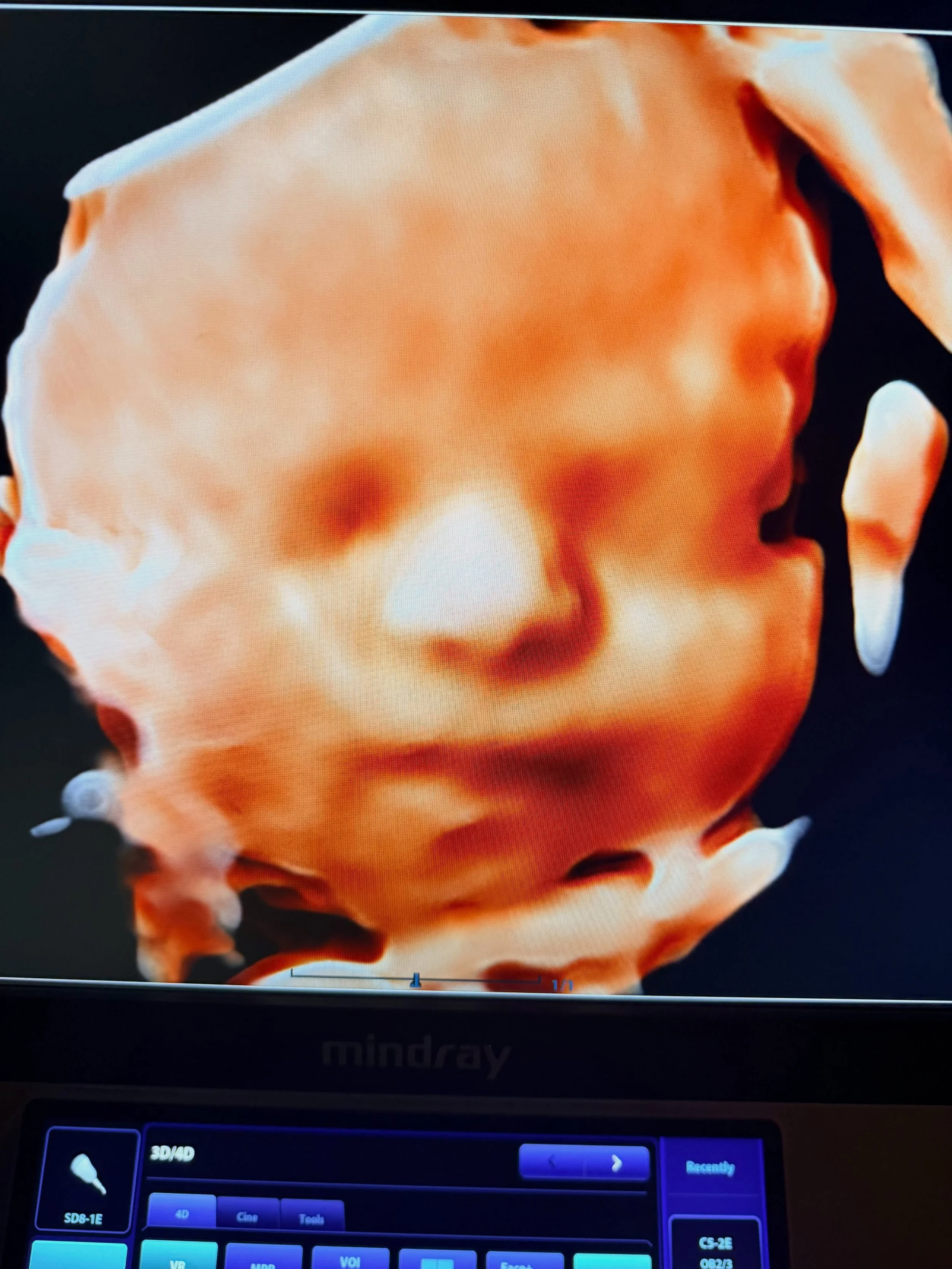 ✨Last Look✨ was so worth it! This is our package 35 weeks and up!