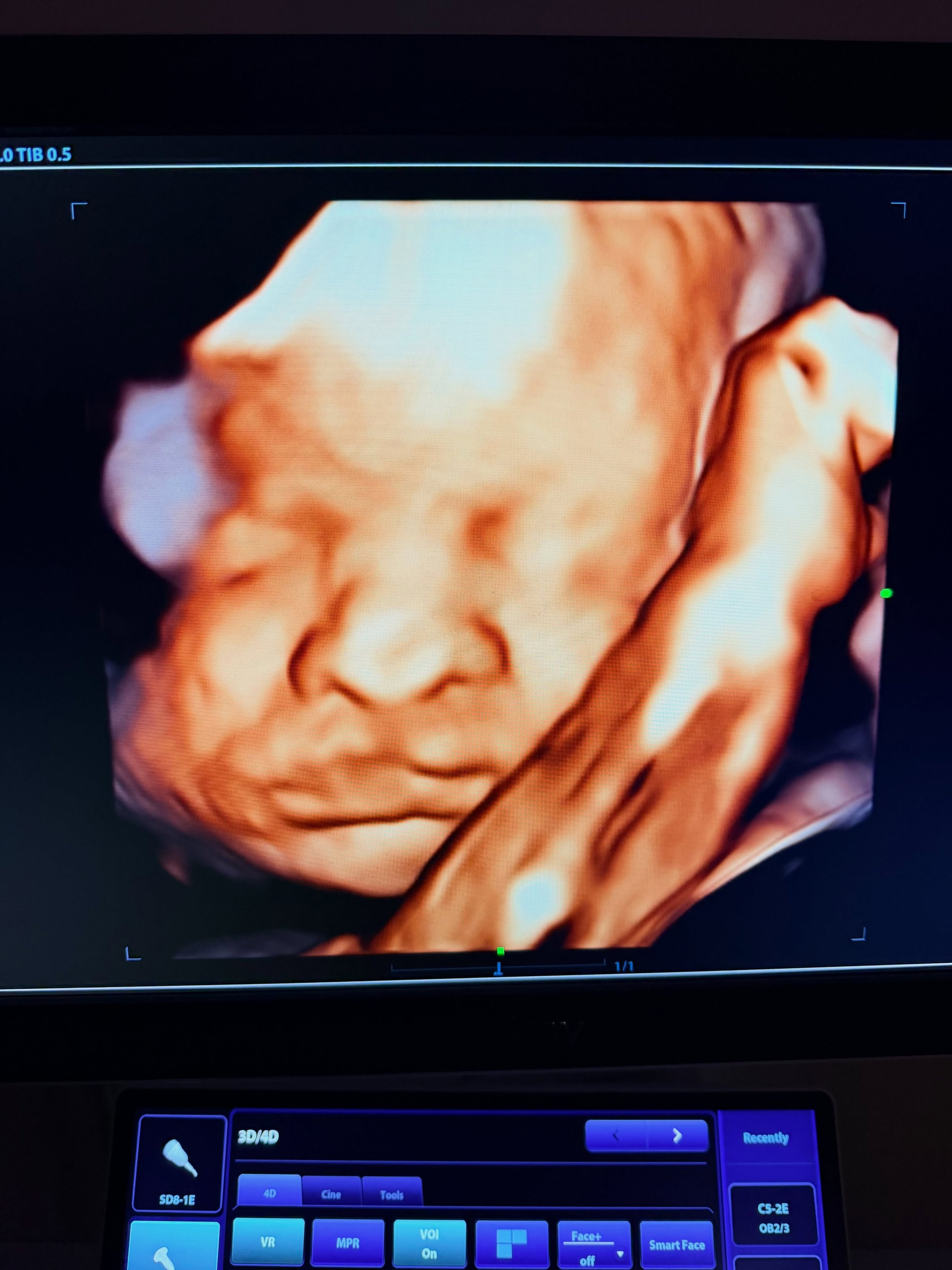 Willow Park babes are too cute lately! This was a part of our Sweet Cheeks 3D/4D package!