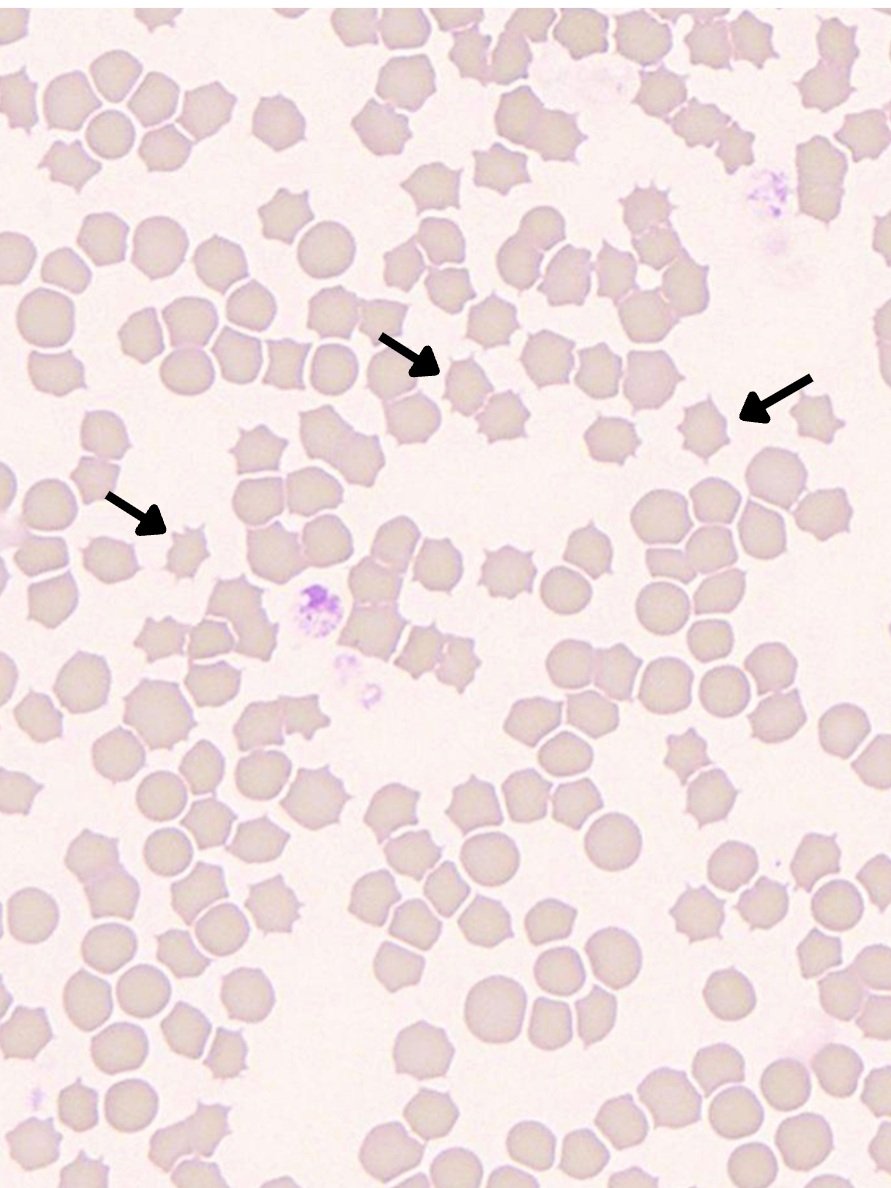 Echino Rbc Clinically Significant RBC Morphological Abnormalities in Veterinary ...