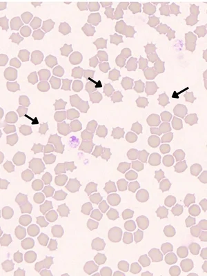 Clinically Significant RBC Morphological Abnormalities in Veterinary ...