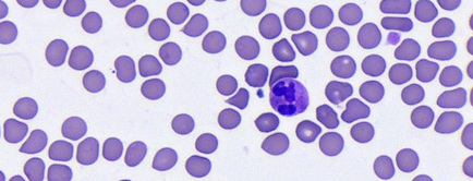 Microscopic image of red and white blood cells