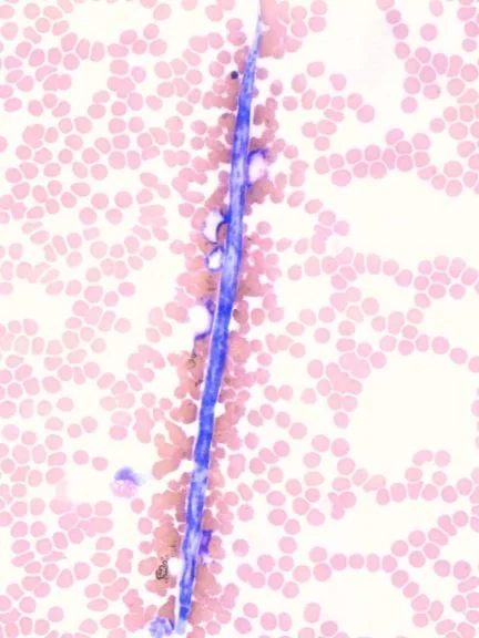Clinically Significant RBC Morphological Abnormalities in Veterinary ...