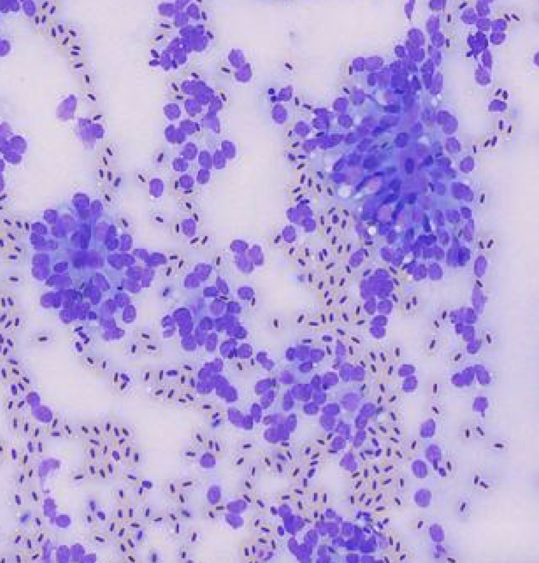 Microscopic view of stained cells in purple clusters on a light background.