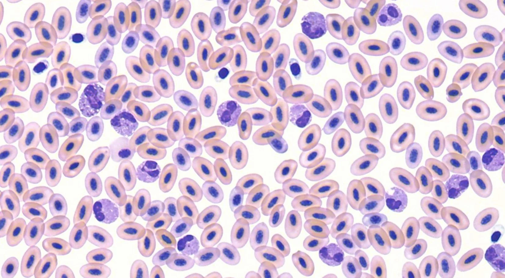 Microscopic view of oval-shaped erythrocytes, likely avian, with purple nuclei visible.