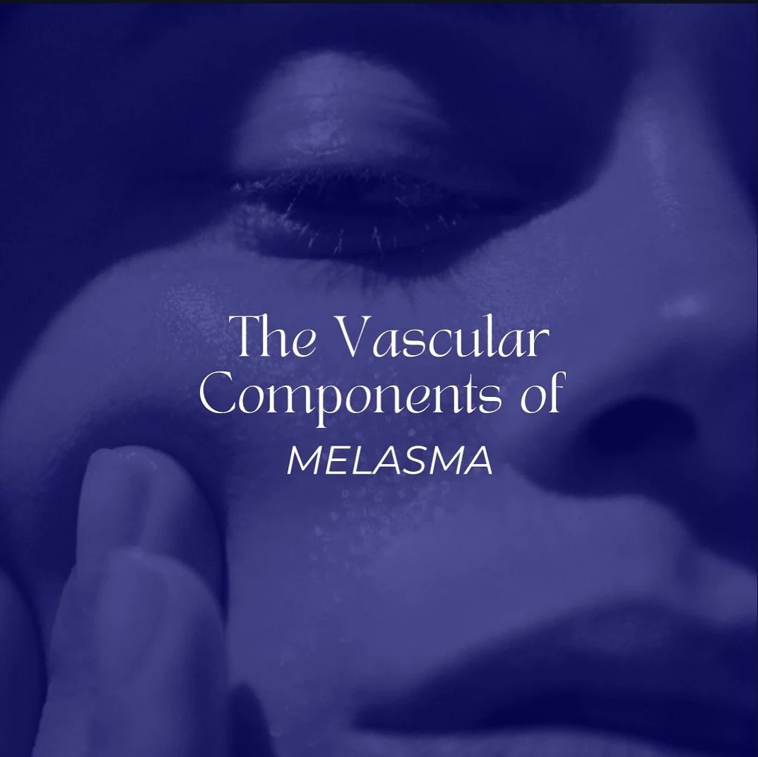 It has been shown that the development of pigmentation in Melasma can be influenced by the interaction between melanocytes (pigment cells) and the cutaneous vasulature (capillary/vascular network). 

Elevated vascularisation of Melasma has been assoc