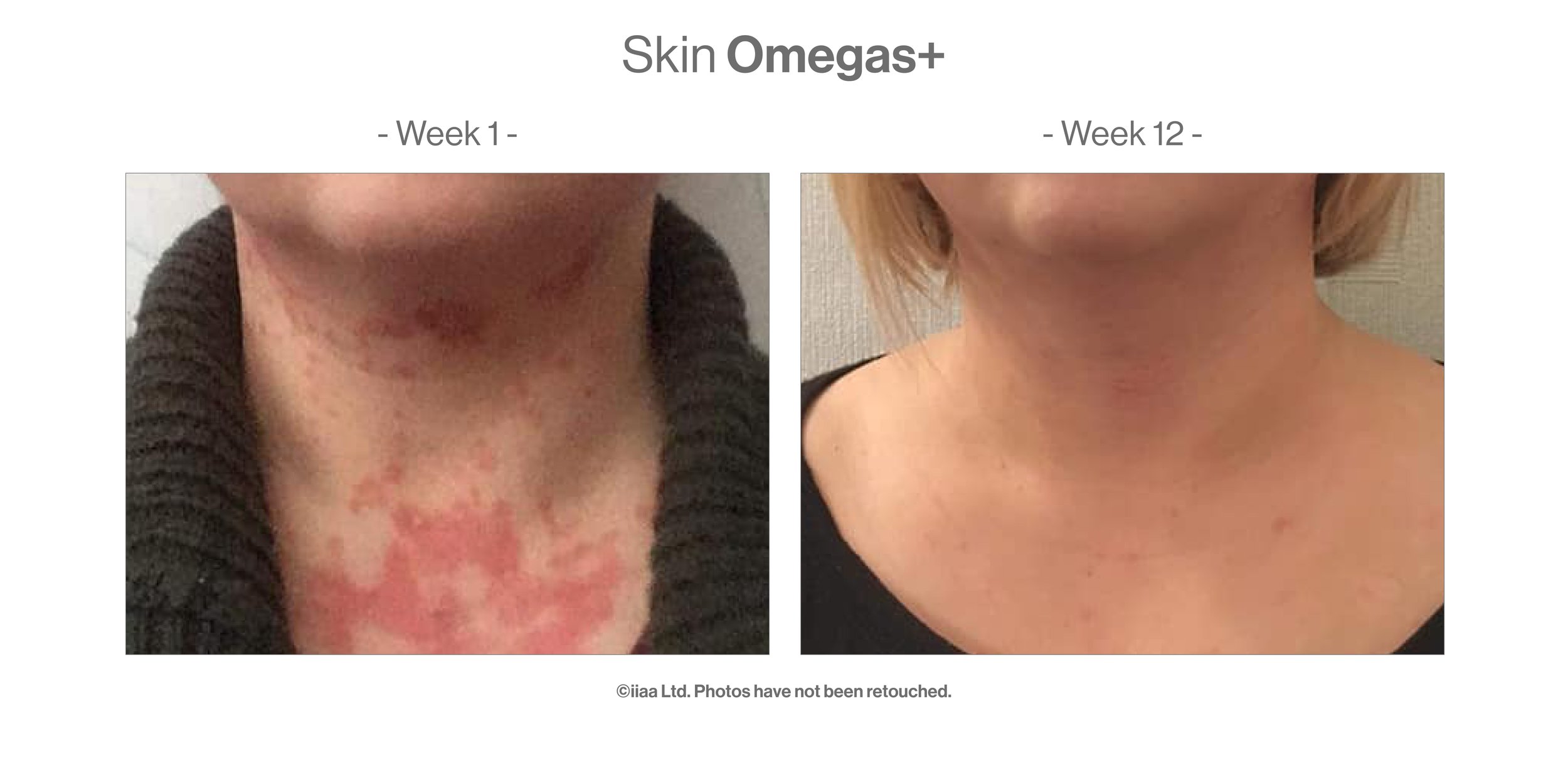 Advanced-Nutrition-Programme-Case-Study-Results_Skin-Omegas--1.jpg