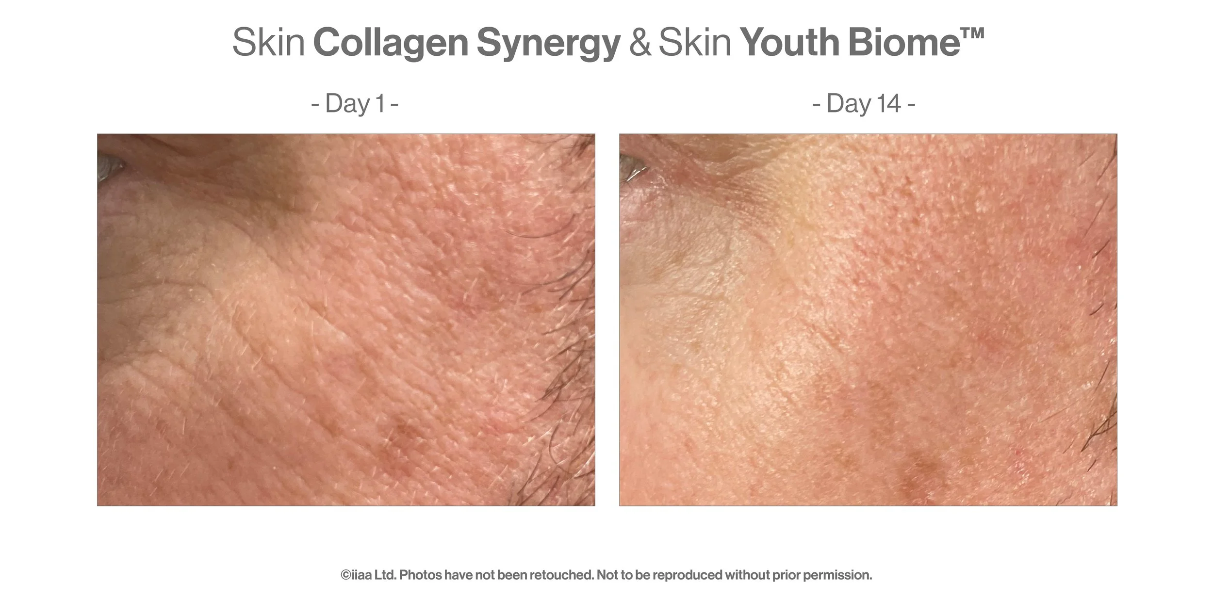 Advanced-Nutrition-Programme-Case-Study-Results_Skin-Collagen-Synergy.jpg