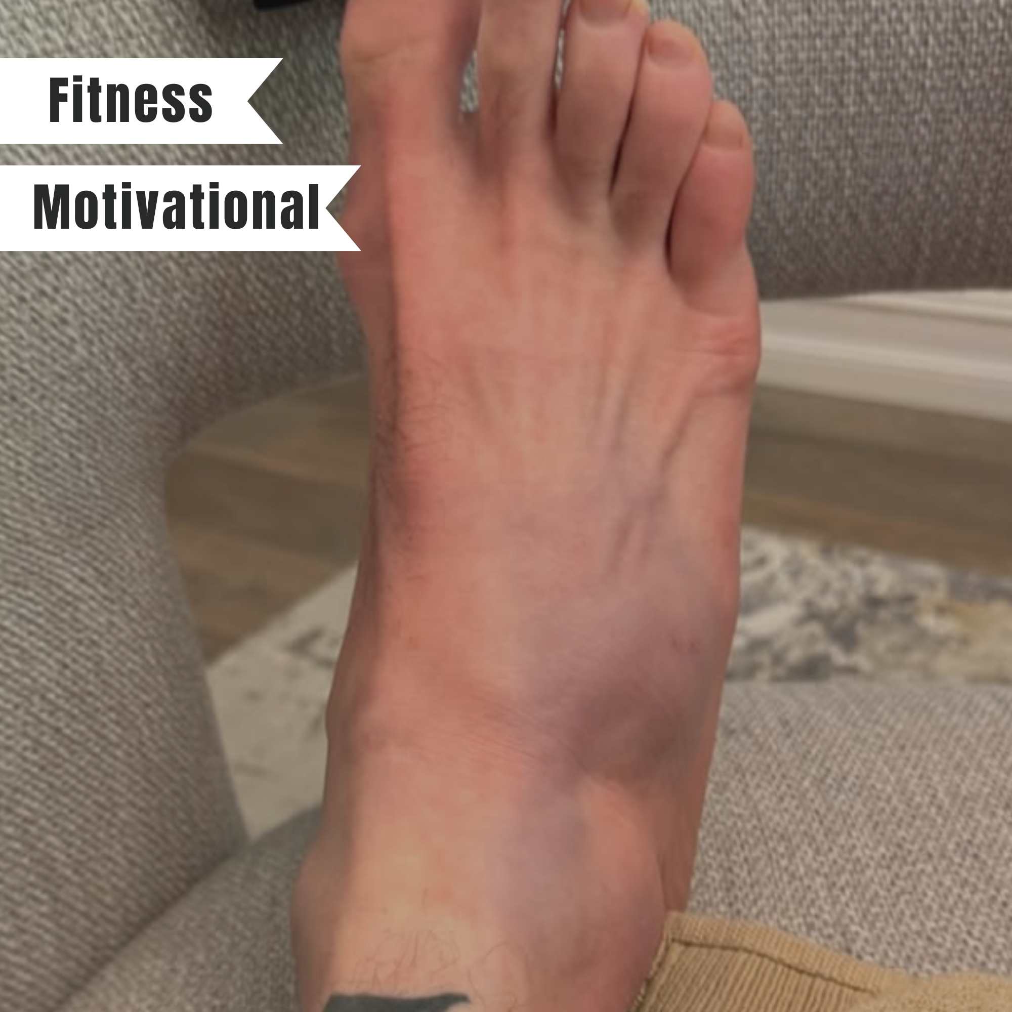 Running on Determination: How I’m Crushing Leg Day with a Fractured Foot
