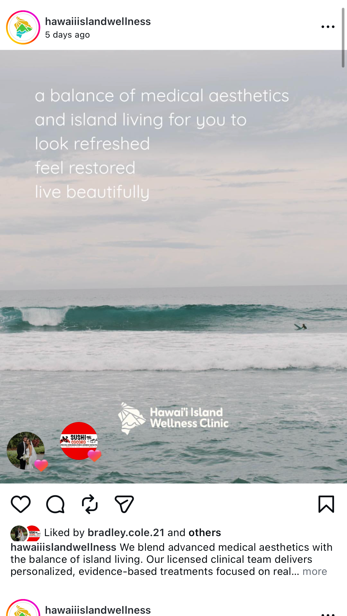 A scenic view of the ocean with a person surfing on a wave, cloudy sky, and text overlay promoting Hawaii Island Wellness Clinic's services for medical aesthetics and island living.