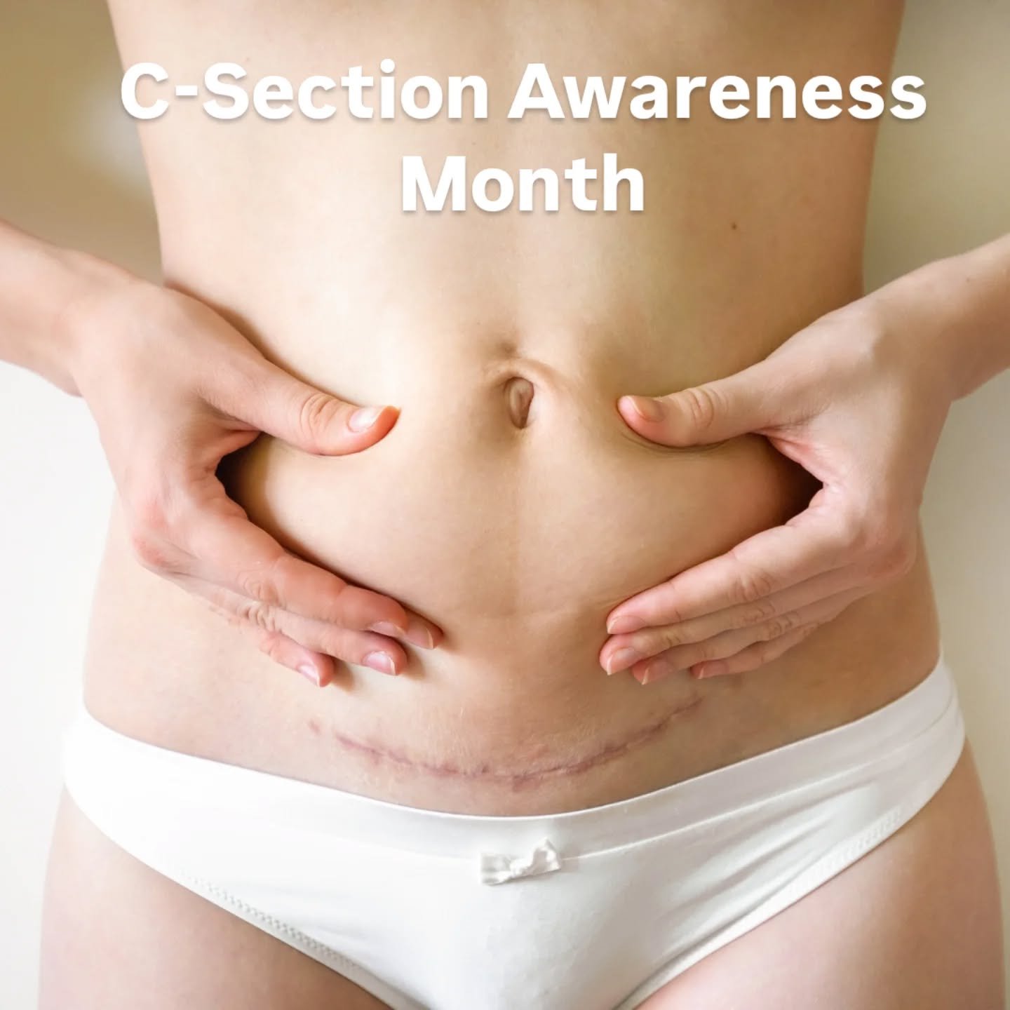 April is C-Section Awareness Month 💛

If you&rsquo;ve had a C-section (recently or years ago), this month is a great reminder that your scar &mdash; and your body &mdash; deserve a little extra care and attention.

Over the next few weeks I&rsquo;ll