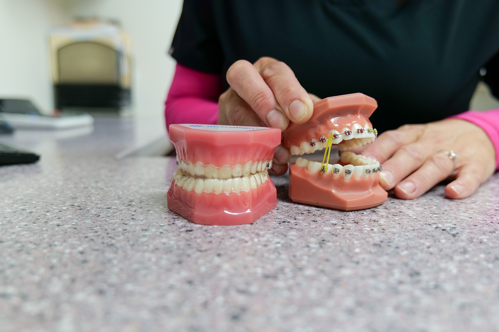 A person holding a dental model with braces, demonstrating orthodontic treatment, on a speckled countertop with another dental model in front.
