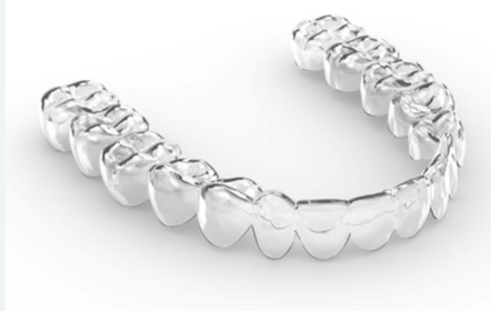 A clear Invisalign aligner tray for teeth straightening.