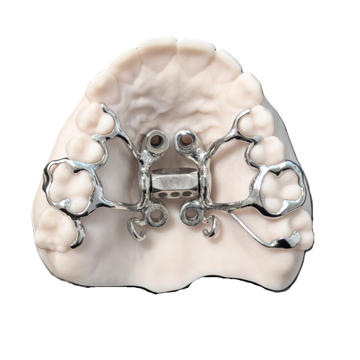 Dental cast model with metal framework for a removable partial denture.