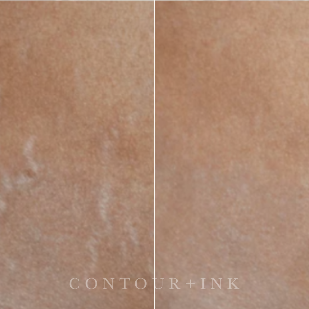 A split image showing a close-up view of skin with even tone on the right side and irregular, uneven skin tone, with some visible patches, on the left side.