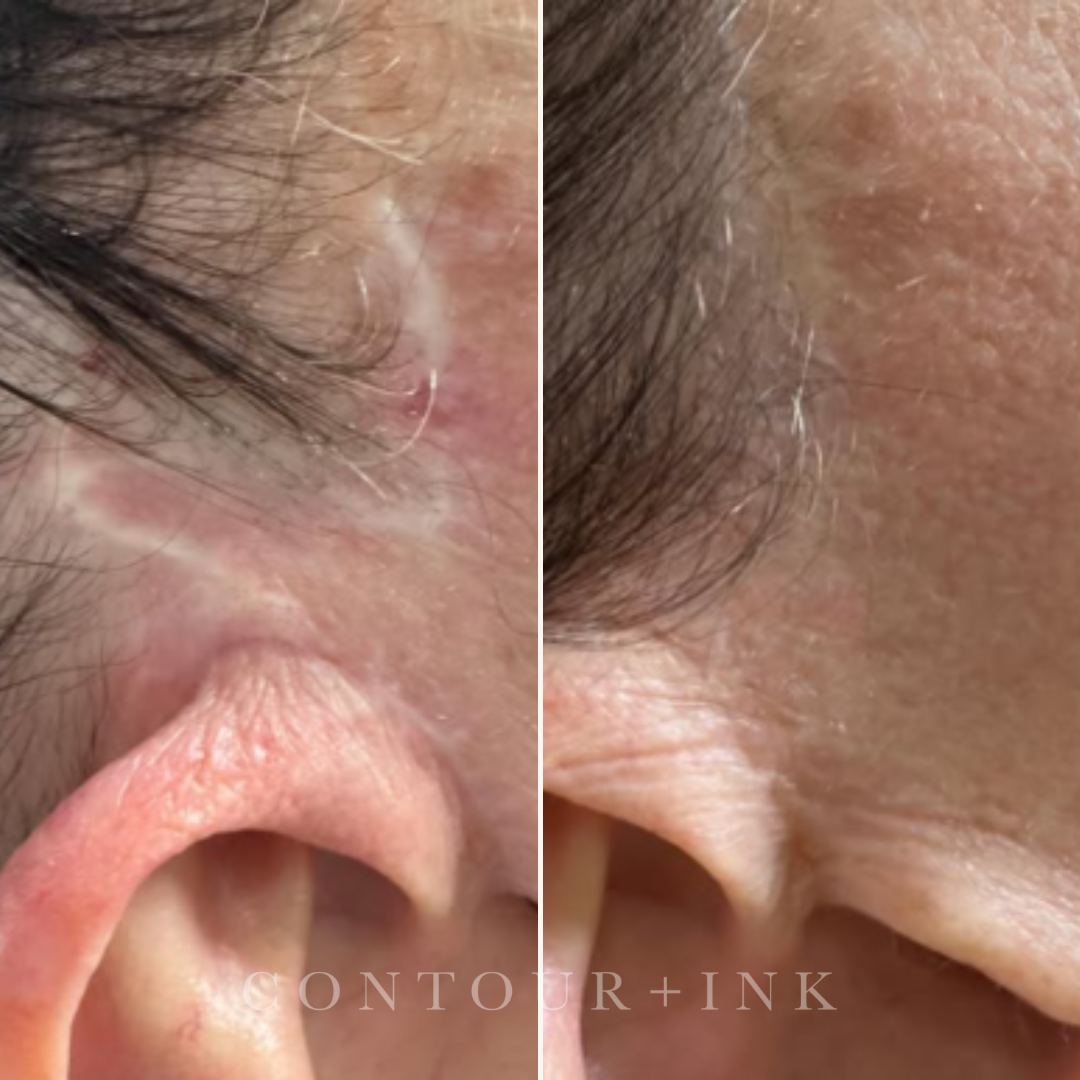 Close-up of a person's nose and surrounding skin, showing hair and skin texture from different angles.