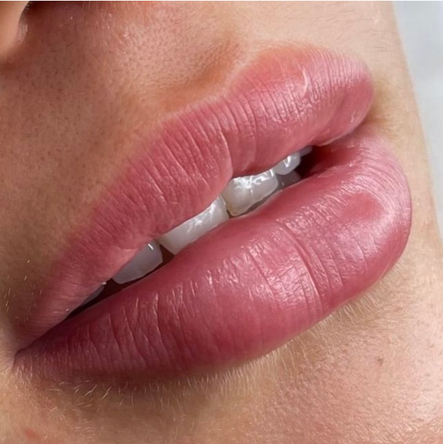 Close-up of lips with slightly parted teeth showing.